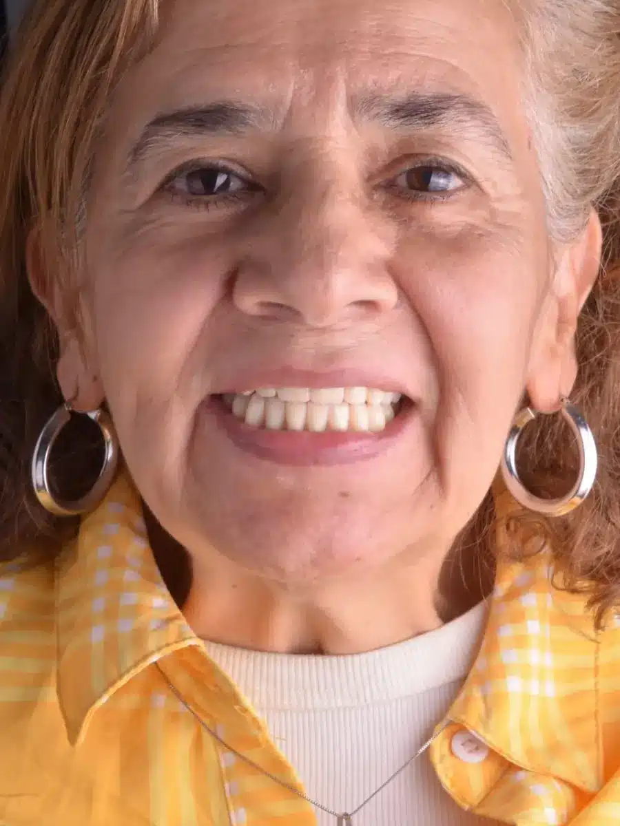 Paciente mayor sonriendo con su prótesis dental