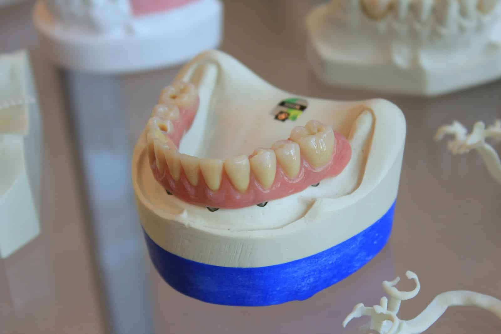 Rehabilitación oral en Medellín: piezas protésicas sobre soporte, imagen de referencia