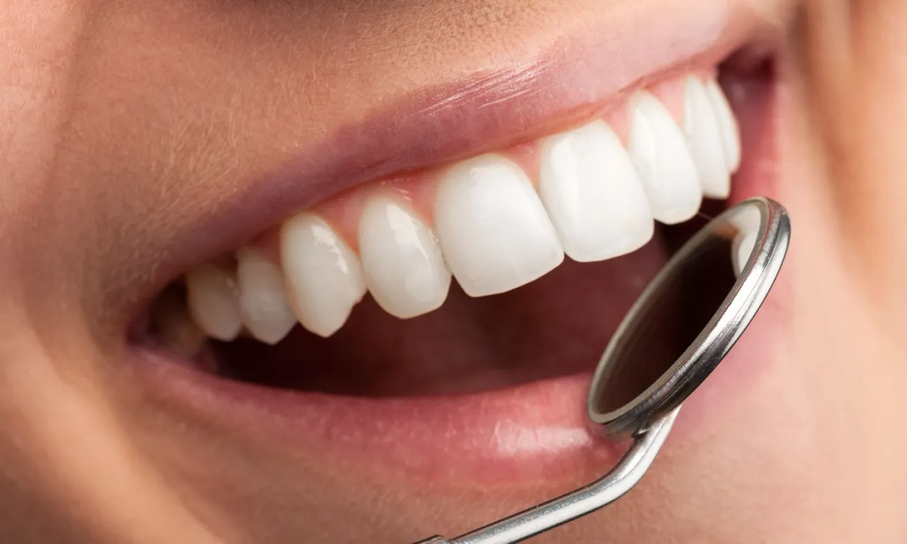 Revisión dental con espejo sobre una sonrisa